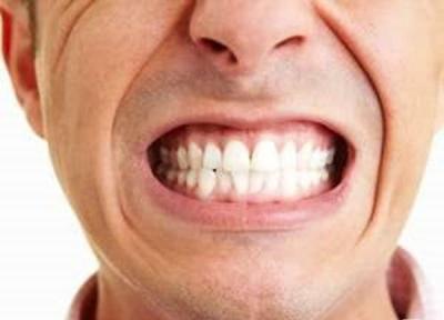 دندان قروچه چه بلایی سر دندان های شما می آورد؟