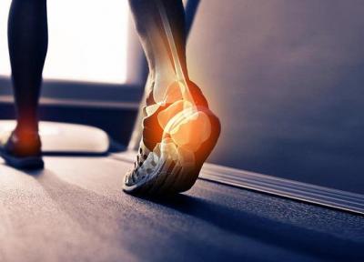درمان های خانگی برای گرفتگی عضلات پا