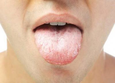 علت تلخی دهان در صبح چیست؟