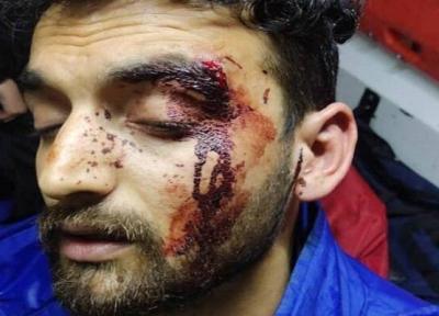 حمله خونین به تکنسین های اورژانس تهران با چاقو و قمه