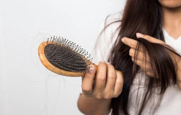 از نظر متخصصان ریزش چند تار مو در روز طبیعی است؟
